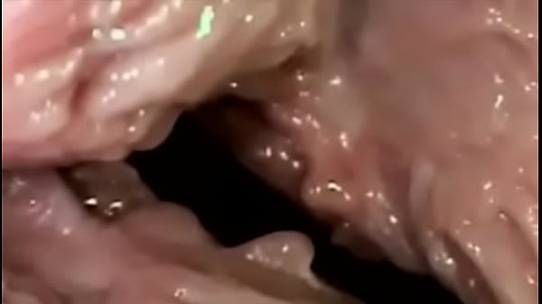 vagina surgery into dick